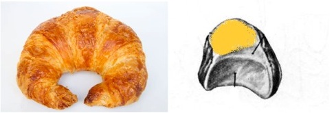 Left: Croissant Right: Left lunate, articulation for the triquetral highlighted in yellow.