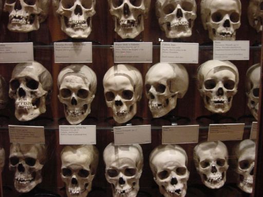 Skulls on display at the Mütter Museum in Philadelphia