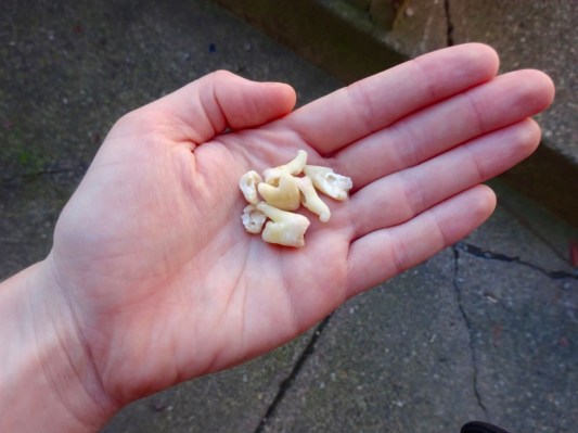Fistful of molars